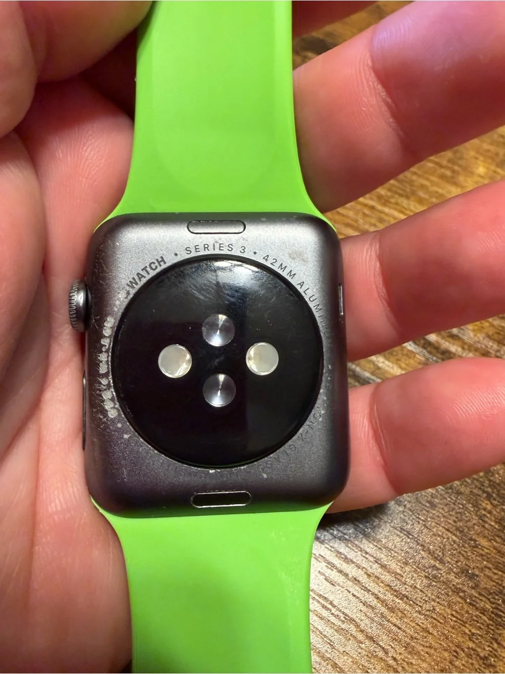 Apple watch series